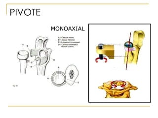 PIVOTE MONOAXIAL 