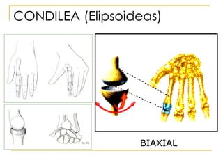 CONDILEA (Elipsoideas)   BIAXIAL 