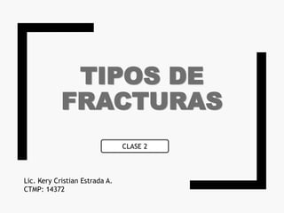 TIPOS DE
FRACTURAS
Lic. Kery Cristian Estrada A.
CTMP: 14372
CLASE 2
 