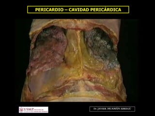 PERICARDIO – CAVIDAD PERICÁRDICA
Dr. JAVIER. HUAMÁN ABREGÚ
 