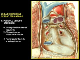 Dr. JAVIER. HUAMÁN ABREGÚ
10
11
LÍNEA DE REPLIEGUE
SEROSO PERICÁRDICO
C. PEDÍCULO VENOSO
IZQUIERDO
10. Vena pulmonar inferior
izquierda
11. Vena pulmonar
superior izquierda
1. Rama izquierda de la
arteria pulmonar
1
 