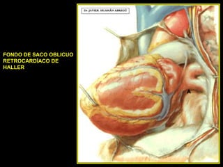 FONDO DE SACO OBLICUO
RETROCARDÍACO DE
HALLER
A
Dr. JAVIER. HUAMÁN ABREGÚ
 