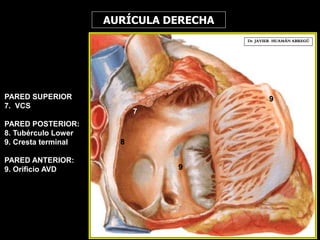 PARED SUPERIOR
7. VCS
PARED POSTERIOR:
8. Tubérculo Lower
9. Cresta terminal
PARED ANTERIOR:
9. Orificio AVD
Dr. JAVIER. HUAMÁN ABREGÚ
AURÍCULA DERECHA
7
8
9
9
 