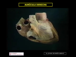 AURÍCULA DERECHA
Dr. JAVIER. HUAMÁN ABREGÚ
 