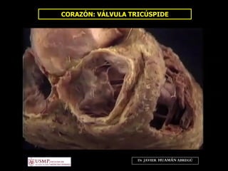 CORAZÓN: VÁLVULA TRICÚSPIDE
Dr. JAVIER. HUAMÁN ABREGÚ
 