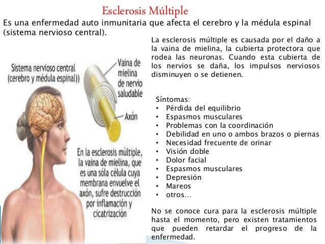 La radiografía sheynogo del departamento de la vértebra
