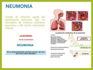 NEUMONIA
Estado de infección aguda del
parénquima pulmonar que se
acompaña de síntomas pulmonar
generales y del tracto respiratorio
inferior.
 