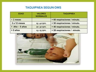 TAQUIPNEA SEGUN OMS
EDAD VALORES
NORMALES
TAQUIPNEA
< 2 meses > 60 respiraciones / minuto.
2 a 12 meses 25- 40 rpm. > 50 respiraciones / minuto.
1 Año – 5 años 20- 30 rpm. > 40 respiraciones / minuto.
> 5 años 15- 25 rpm. > 28 respiraciones / minuto.
 