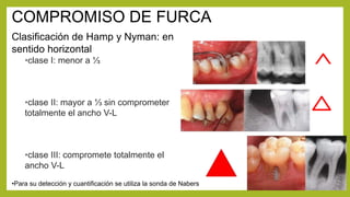 Hamp Classification Parametros a registrar en un Periodontograma | PPTX