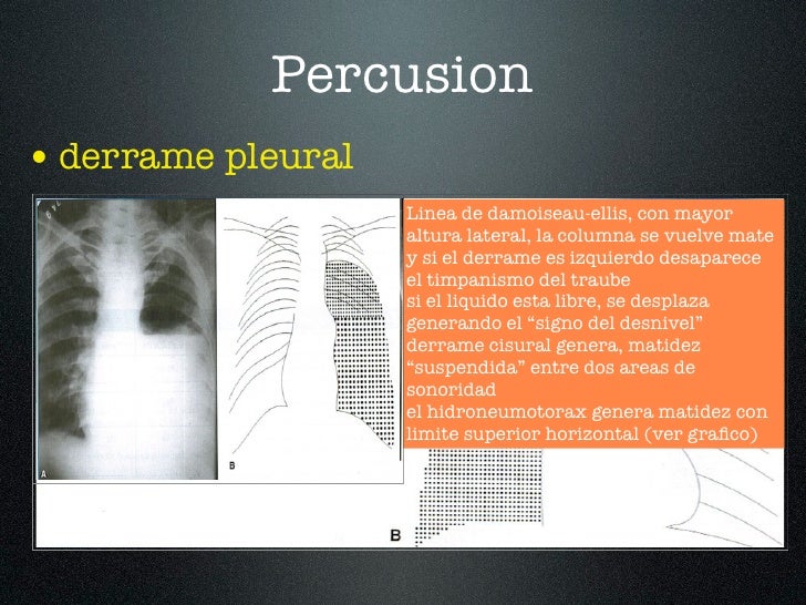 Clase 3 examen aparato respiratorio