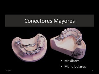 Conectores Mayores
• Maxilares
• Mandibulares
5/1/2013 8
 