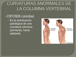  CIFOSIS   (Joroba)
 • Es la acentuación
   patológica de una
   curvatura cóncava
   (primaria), hacia
   adelante.
 