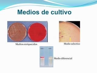 Medios de cultivo



Medios enriquecidos            Medio selectivo




                      Medio diferencial
 