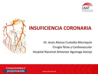 www.usat.edu.pe
www.usat.edu.pe
Dr. Jesús Alonso Custodio Marroquín
Cirugía Tórax y Cardiovascular
Hospital Nacional Almanzor Aguinaga Asenjo
INSUFICIENCIA CORONARIA
 