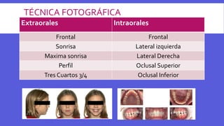 TÉCNICA FOTOGRÁFICA
Extraorales Intraorales
Frontal Frontal
Sonrisa Lateral izquierda
Maxima sonrisa Lateral Derecha
Perfil Oclusal Superior
Tres Cuartos 3/4 Oclusal Inferior
 
