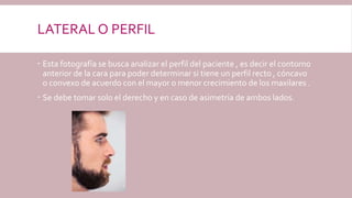 LATERAL O PERFIL
 Esta fotografía se busca analizar el perfil del paciente , es decir el contorno
anterior de la cara para poder determinar si tiene un perfil recto , cóncavo
o convexo de acuerdo con el mayor o menor crecimiento de los maxilares .
 Se debe tomar solo el derecho y en caso de asimetría de ambos lados.
 