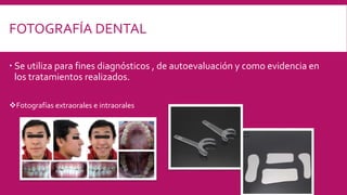 FOTOGRAFÍA DENTAL
 Se utiliza para fines diagnósticos , de autoevaluación y como evidencia en
los tratamientos realizados.
Fotografías extraorales e intraorales
 