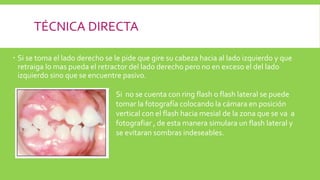 TÉCNICA DIRECTA
 Si se toma el lado derecho se le pide que gire su cabeza hacia al lado izquierdo y que
retraiga lo mas pueda el retractor del lado derecho pero no en exceso el del lado
izquierdo sino que se encuentre pasivo.
Si no se cuenta con ring flash o flash lateral se puede
tomar la fotografía colocando la cámara en posición
vertical con el flash hacia mesial de la zona que se va a
fotografiar , de esta manera simulara un flash lateral y
se evitaran sombras indeseables.
 
