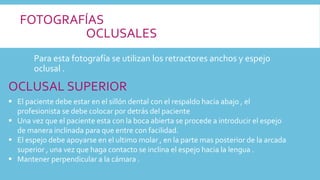 FOTOGRAFÍAS
OCLUSALES
Para esta fotografía se utilizan los retractores anchos y espejo
oclusal .
OCLUSAL SUPERIOR
 El paciente debe estar en el sillón dental con el respaldo hacia abajo , el
profesionista se debe colocar por detrás del paciente
 Una vez que el paciente esta con la boca abierta se procede a introducir el espejo
de manera inclinada para que entre con facilidad.
 El espejo debe apoyarse en el ultimo molar , en la parte mas posterior de la arcada
superior , una vez que haga contacto se inclina el espejo hacia la lengua .
 Mantener perpendicular a la cámara .
 