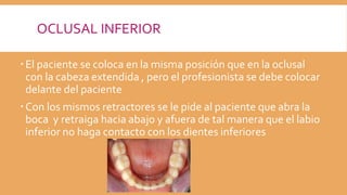 OCLUSAL INFERIOR
El paciente se coloca en la misma posición que en la oclusal
con la cabeza extendida , pero el profesionista se debe colocar
delante del paciente
Con los mismos retractores se le pide al paciente que abra la
boca y retraiga hacia abajo y afuera de tal manera que el labio
inferior no haga contacto con los dientes inferiores
 
