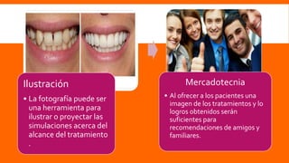 Ilustración
• La fotografía puede ser
una herramienta para
ilustrar o proyectar las
simulaciones acerca del
alcance del tratamiento
.
Mercadotecnia
• Al ofrecer a los pacientes una
imagen de los tratamientos y lo
logros obtenidos serán
suficientes para
recomendaciones de amigos y
familiares.
 
