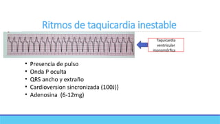 Cardioversion 100j Taquiaritmias y bradiarritmias en trazos electrocardigraficos.pptx
