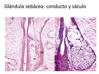 Glándula sebácea: conducto y sáculo
 