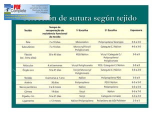 Selección de sutura según tejido
 