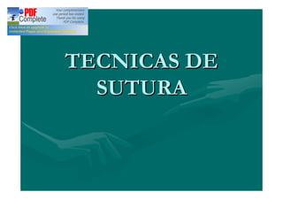 TECNICAS DE
  SUTURA
 