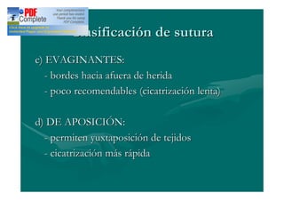 Clasificación de sutura
c) EVAGINANTES:
   - bordes hacia afuera de herida
   - poco recomendables (cicatrización lenta)

d) DE APOSICIÓN:
  - permiten yuxtaposición de tejidos
  - cicatrización más rápida
 