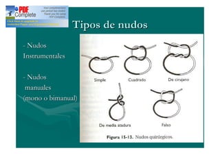 Tipos de nudos
- Nudos
Instrumentales

- Nudos
 manuales
(mono o bimanual)
 