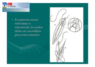 En patrones sutura
subcutánea o
subcuticular, los nudos
deben ser escondidos
para evitar irritación
 