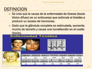 Trastorno de la Glandula Tiroides




DEFINICION
    Se cree que la causa de la enfermedad de Graves (bocio
     tóxico difuso) es un anticuerpo que estimula el tiroides a
     producir un exceso de hormonas.
    Dado que la glándula completa es estimulada, aumenta
     mucho de tamaño y causa una tumefacción en el cuello
     (bocio).




                                                                  16
 