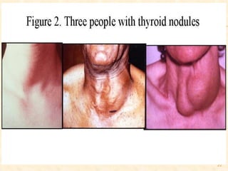 Trastorno de la Glandula Tiroides




                                    22
 