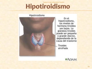 Trastorno de la Glandula Tiroides




                                    28
 