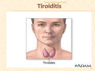 Trastorno de la Glandula Tiroides




                                    33
 