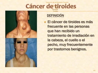 Trastorno de la Glandula Tiroides

        Trastorno
             de la
        Glandula
          Tiroides


    DEFINICIÓN
   El cáncer de tiroides es más
    frecuente en las personas
    que han recibido un
    tratamiento de irradiación en
    la cabeza, el cuello o el
    pecho, muy frecuentemente
    por trastornos benignos.




                                    44
 