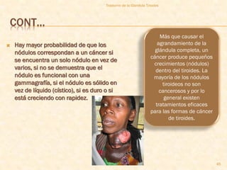 Trastorno de la Glandula Tiroides




CONT…
                                                                       Más que causar el
   Hay mayor probabilidad de que los                                 agrandamiento de la
    nódulos correspondan a un cáncer si                              glándula completa, un
                                                                   cáncer produce pequeños
    se encuentra un solo nódulo en vez de
                                                                    crecimientos (nódulos)
    varios, si no se demuestra que el                                dentro del tiroides. La
    nódulo es funcional con una                                     mayoría de los nódulos
    gammagrafía, si el nódulo es sólido en                              tiroideos no son
    vez de líquido (cístico), si es duro o si                          cancerosos y por lo
    está creciendo con rapidez.                                          general existen
                                                                     tratamientos eficaces
                                                                   para las formas de cáncer
                                                                           de tiroides.




                                                                                               45
 