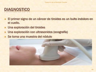 Trastorno de la Glandula Tiroides



DIAGNOSTICO

   El primer signo de un cáncer de tiroides es un bulto indoloro en
    el cuello.
   Una exploración del tiroides
   Una exploración con ultrasonidos (ecografía)
   Se toma una muestra del nódulo




                                                                   46
 