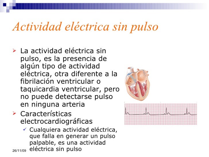 ECG2