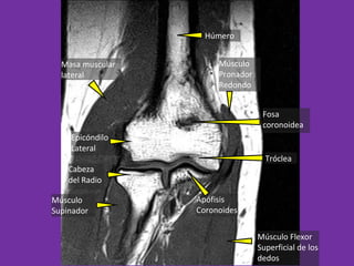 Clase 4 - Brazo, Codo, Antebrazo | PPT
