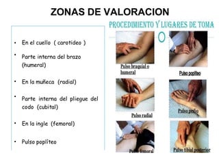 ZONAS DE VALORACION
• En el cuello ( carotideo )
• Parte interna del brazo
(humeral)
• En la muñeca (radial)
• Parte interna del pliegue del
codo (cubital)
• En la ingle (femoral)
• Pulso poplíteo
 