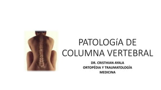 PATOLOGíA DE
COLUMNA VERTEBRAL
DR. CRISTHIAN AYALA
ORTOPÉDIA Y TRAUMATOLOGÍA
MEDICINA
 