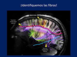 ¡Identifiquemos las fibras!
Fibras cortas
Fascículo
longitudinal
superior
Fascículo
longitudinal
inferior
 