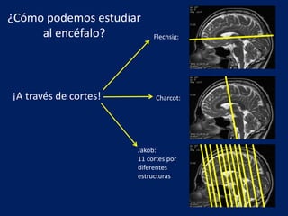 ¿Cómo podemos estudiar
al encéfalo?
¡A través de cortes!
Flechsig:
Charcot:
Jakob:
11 cortes por
diferentes
estructuras
 