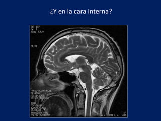 ¿Y en la cara interna?
 