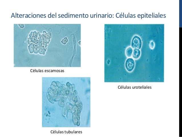 Células Epiteliales Planas En Orina Valores Normales es.slideshare.net