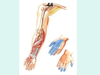 44
 