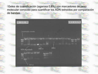 Geles de cuantificación (agarosa 0,8%) con marcadores de peso
molecular conocido para cuantificar los ADN extraídos por comparación
de bandas.
 