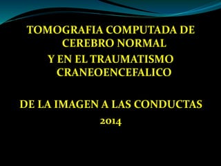 TOMOGRAFIA COMPUTADA DE
CEREBRO NORMAL
Y EN EL TRAUMATISMO
CRANEOENCEFALICO
DE LA IMAGEN A LAS CONDUCTAS
2014
 